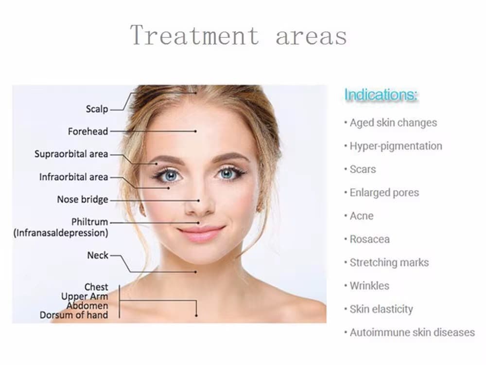 Treatment areas and indications for the PROSKIN system